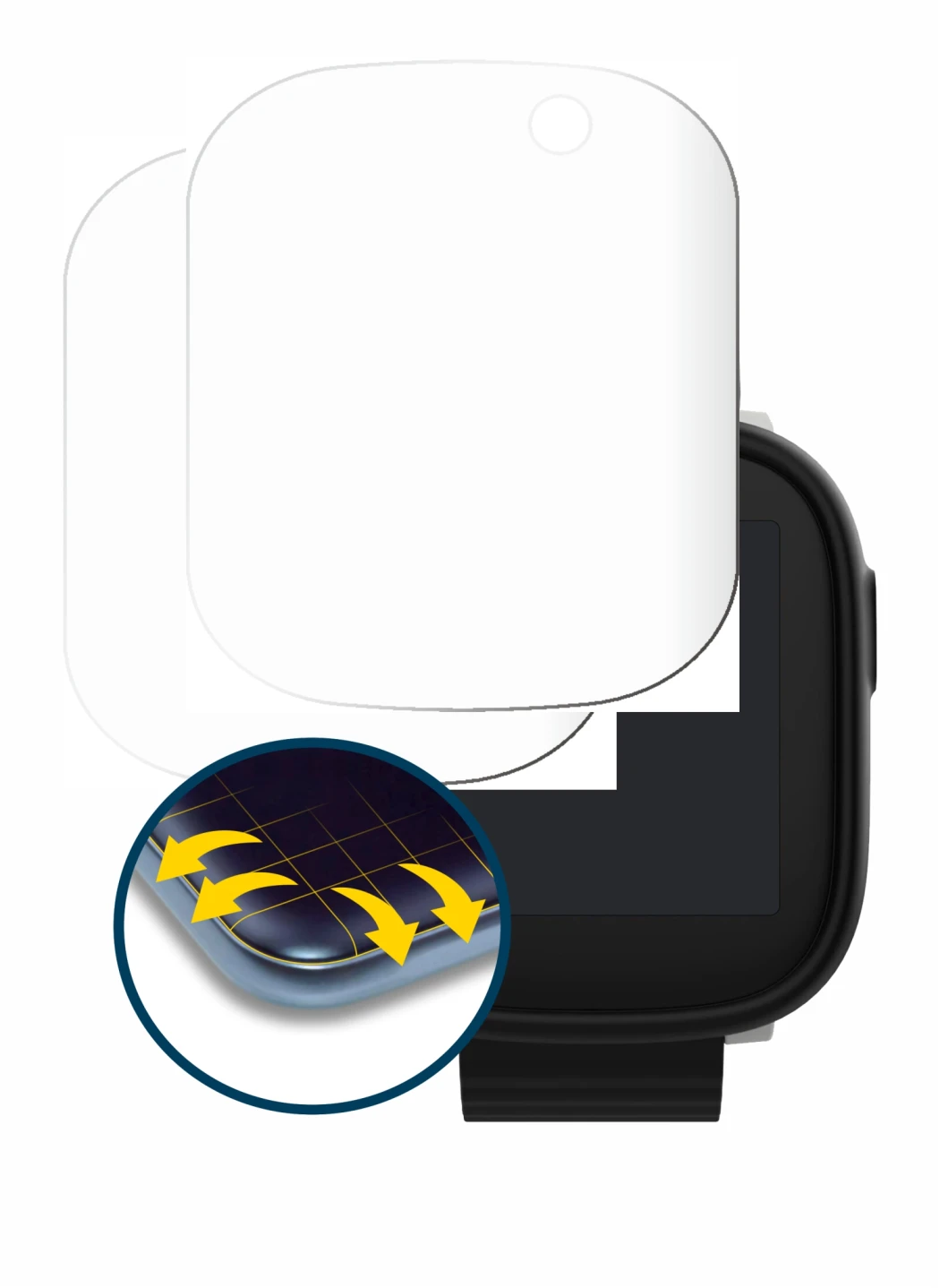 Abbildung des Geräts Xplora X6 Play 2022 (1. Generation) mit einer Vielzahl des Displayschutzes.