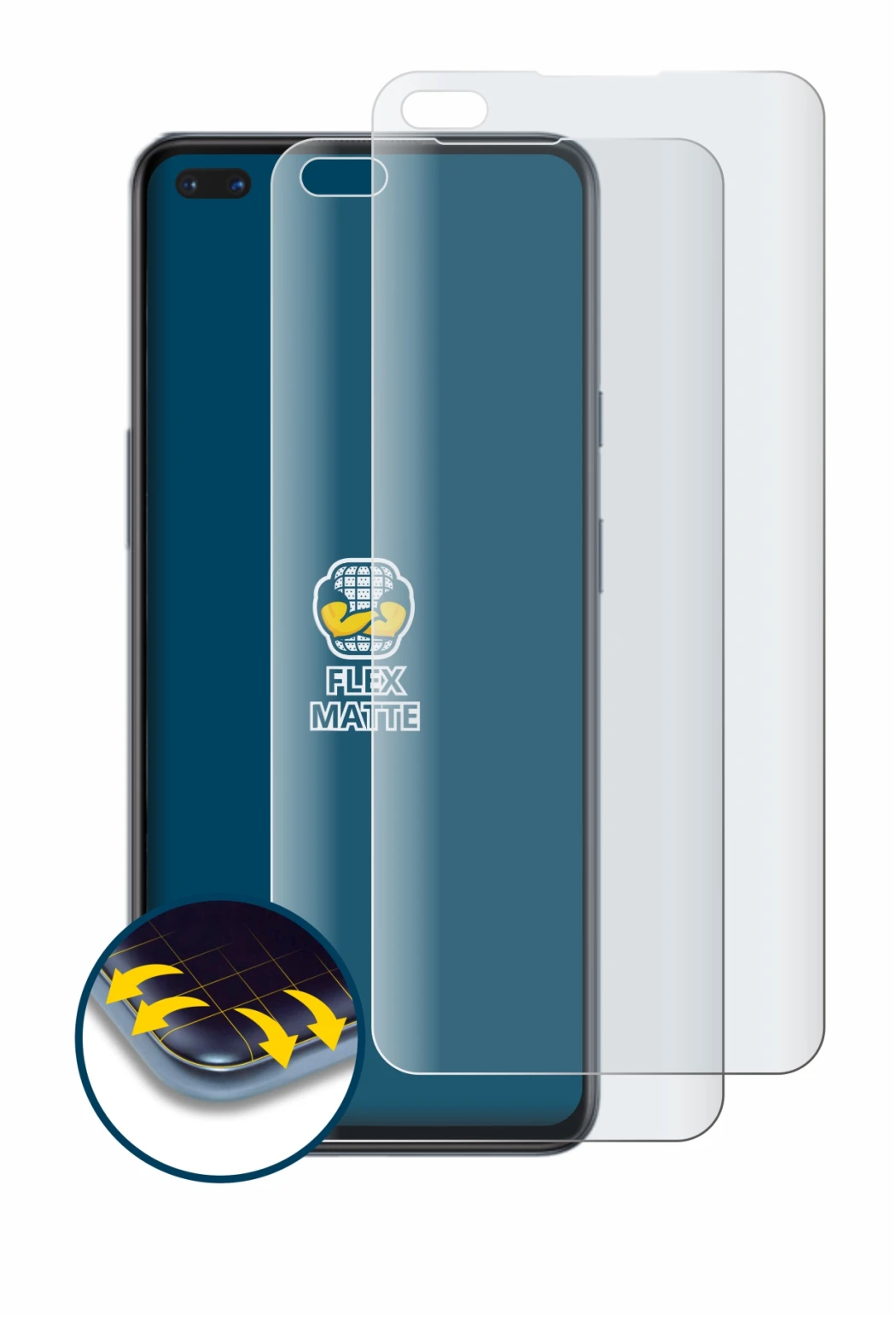 Abbildung des Geräts OnePlus Nord mit einer Vielzahl des Displayschutzes.