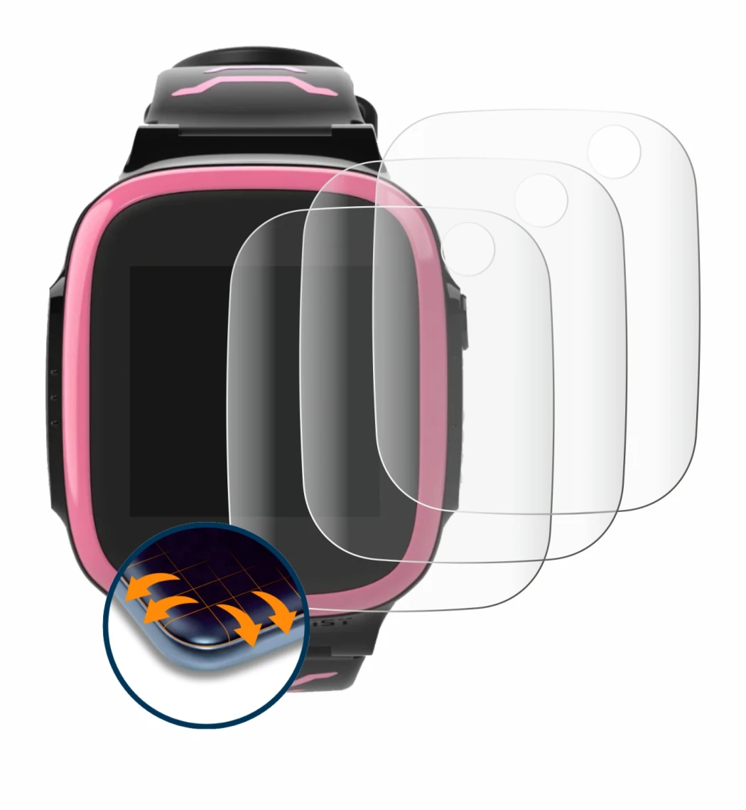 Abbildung des Geräts Xplora X5 Play mit einer Vielzahl des Displayschutzes.