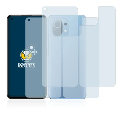 Abbildung des Geräts Xiaomi Mi 11 Lite 5G (Display+Rückseite) mit einer Vielzahl des Displayschutzes.