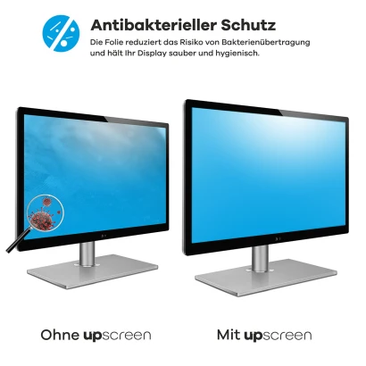 Gerät mit upscreen Displayschutzfolie: Vorher viele Bakterien, nachher sauber – „Anti-Bacteria Protection“.