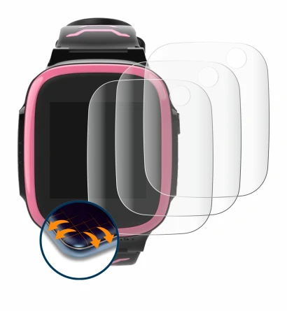 Abbildung des Geräts Xplora X5 Play mit einer Vielzahl des Displayschutzes.