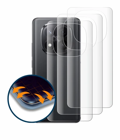 Abbildung des Geräts Xiaomi Redmi Note 14 Pro Plus (Rückseite) mit einer Vielzahl des Displayschutzes.