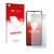 Vorderseite einer Produktverpackung mit dem Markenlogo upscreen. Daneben ist das Gerät Xiaomi Redmi 10 (2022) mit dem zugehöri