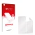 Vorderseite einer Produktverpackung mit dem Markenlogo upscreen. Daneben ist der zugehörige Displayschutz.