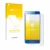 Vorderseite einer Produktverpackung mit dem Markenlogo upscreen. Daneben ist das Gerät Honor 9 mit dem zugehörigen Displayschu