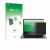 Vorderseite einer Produktverpackung mit dem Markenlogo upscreen. Daneben ist das Gerät Lenovo ThinkPad L13 Gen 5 mit dem zugeh
