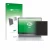 Vorderseite einer Produktverpackung mit dem Markenlogo upscreen. Daneben ist das Gerät HP OmniBook 5 14 mit dem zugehörigen Di