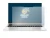 Abbildung des Geräts HP Elitebook x360 1040 G7 mit einer Vielzahl des Displayschutzes.